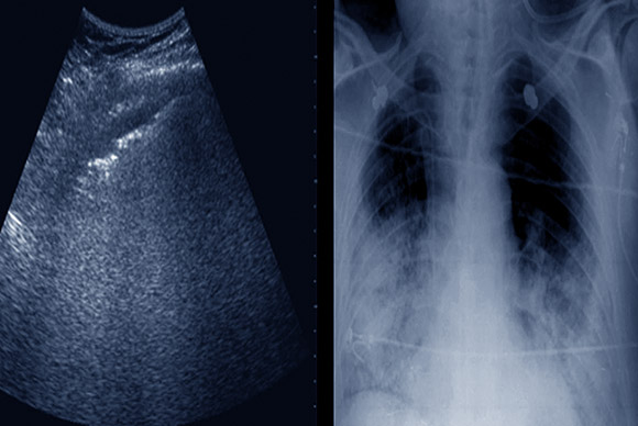 Ultrasonography & X-Ray